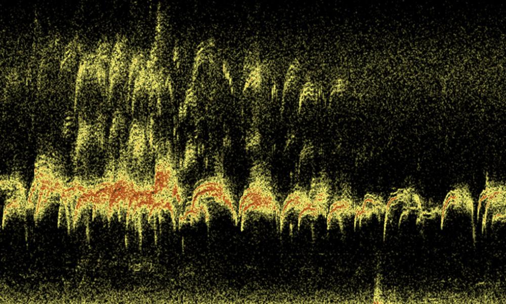 Acustic waves